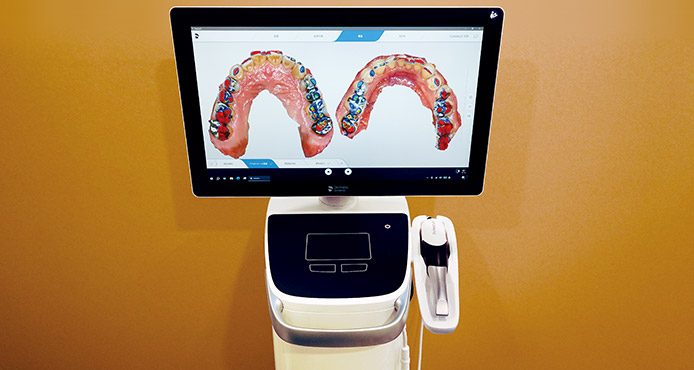 口腔内スキャナー（Sirona Primescan）