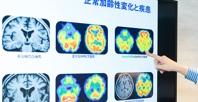 sp正常加齢性変化と疾患